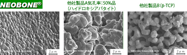 気孔構造の比較－骨格部構造－